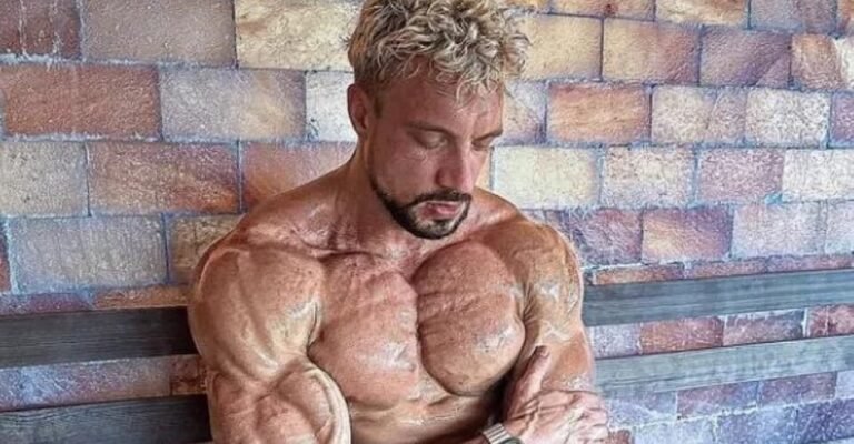 What Is Rippling Muscle Disease What Causes an Aneurysm Jo Lindner's Cause of Death Explored
