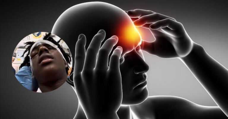 What Is a Cluster Headache IShowSpeed's Critical Problem Explained