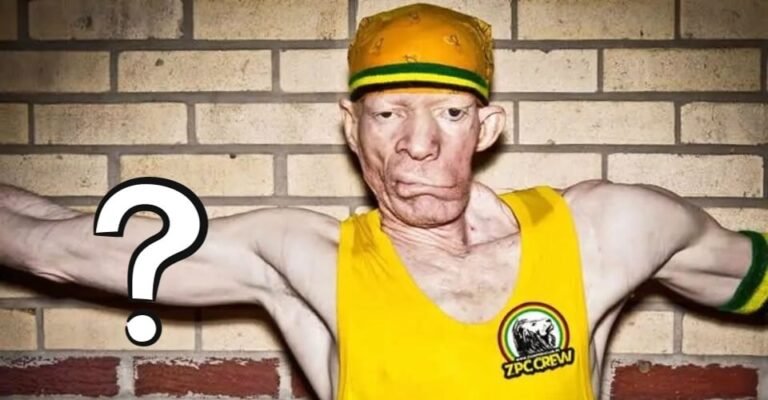 What Happened to Yellowman's Face
