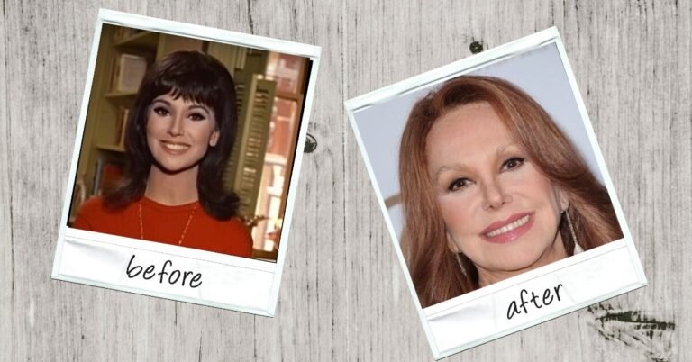 What Happened to Marlo Thomas Face?