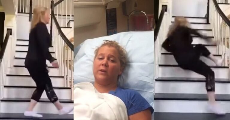 Was Amy Schumer Really Hospitalized? Viral Tiktok Video of Amy Schumer Falling from the Stairs Explained