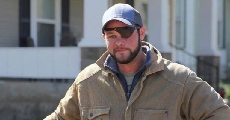 What Happened to Chase on Fixer to Fabulous? What's Wrong With His Eye?