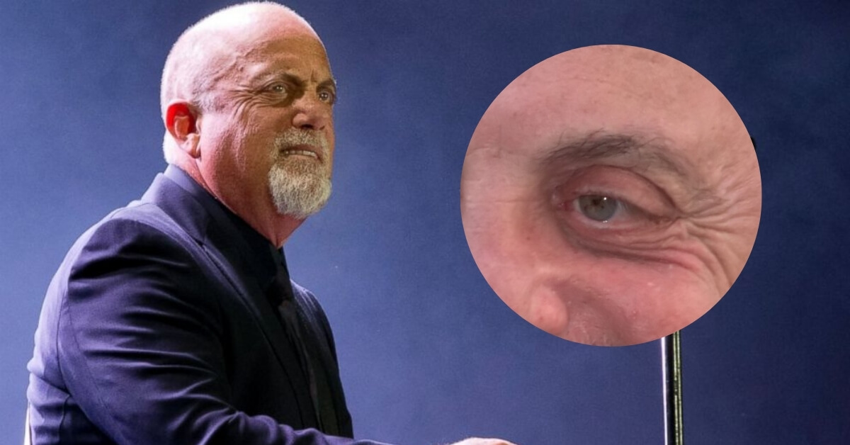 What Happened to Billy Joel's Eye? Does Billy Have a Glass Eye?